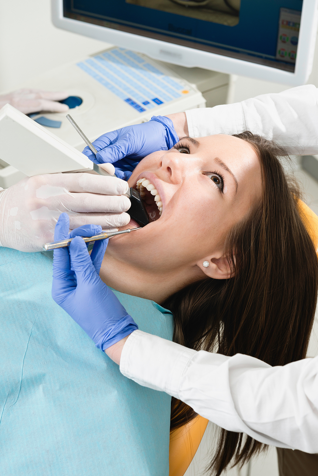 The Future of Dental Restorations: Understanding CEREC in San Jose, CA