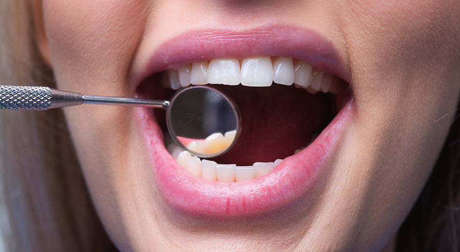 The Science Behind Root Canal Therapy: How It Saves Your Tooth