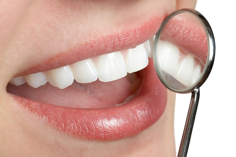 Revitalize Your Smile with Professional Teeth Whitening in San Jose, CA